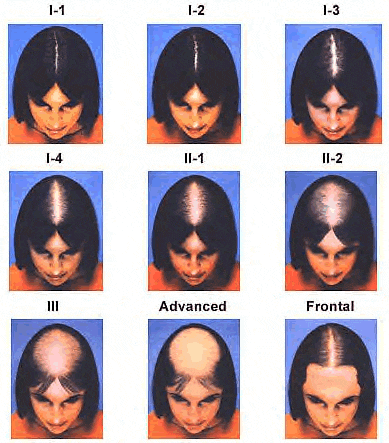 levels for hairs