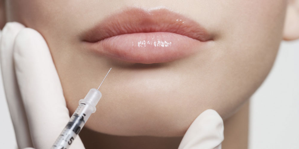 Lips injection