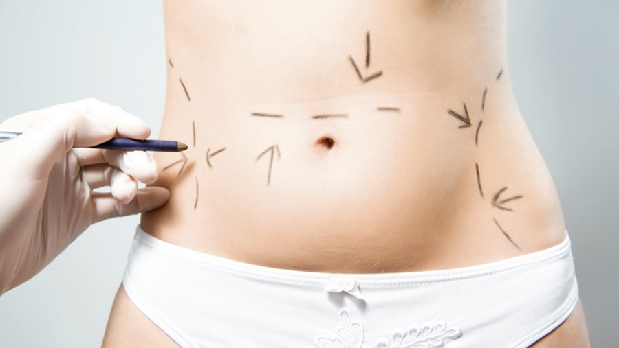 belly fat marking
