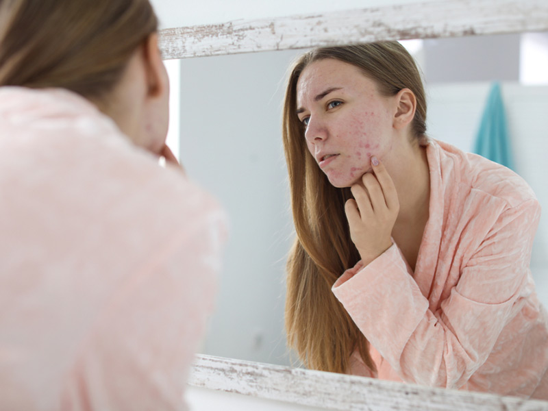 a women checking her face in mirror