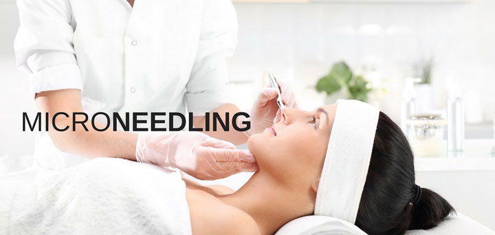 woman receiving microneedling treatment