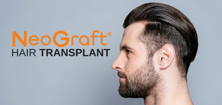man with NeoGraft hair transplant